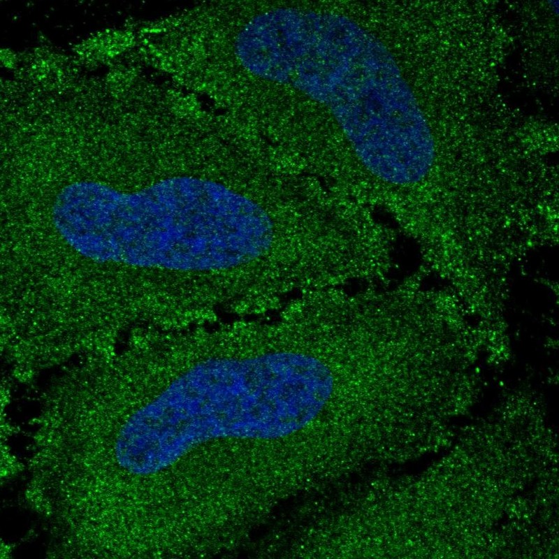 Anti-VWA7 Antibody