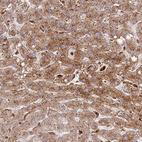 Anti-TTPAL Antibody