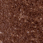 Immunohistochemical staining of human lymphoid tissues shows strong cytoplasmic membranous positivity in non-germinal center cells and germinal center cells.