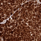 Immunohistochemical staining of human pancreas shows strong cytoplasmic positivity in exocrine glandular cells.