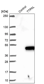Western blot analysis in control (vector only transfected HEK293T lysate) and TTPAL over-expression lysate (Co-expressed with a C-terminal myc-DDK tag (~3.1 kDa) in mammalian HEK293T cells, LY411290).