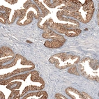 Anti-F8A1 Antibody