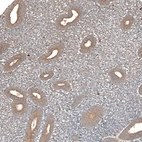 Immunohistochemical staining of human endometrium shows moderate cytoplasmic positivity in glandular cells.