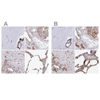 Immunohistochemical staining of human cerebral cortex, kidney, liver and lung using Anti-ANXA2 antibody HPA046964 (A) shows similar protein distribution across tissues to independent antibody HPA061798 (B).