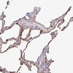 Immunohistochemical staining of human lung shows high expression.