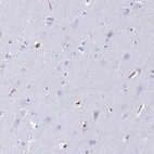 Immunohistochemical staining of human cerebral cortex shows low expression as expected.