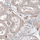Immunohistochemical staining of human testis shows strong cytoplasmic positivity in Leydig cells.