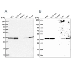 Western blot analysis using Anti-ANXA2 antibody HPA046964 (A) shows similar pattern to independent antibody HPA061798 (B).
