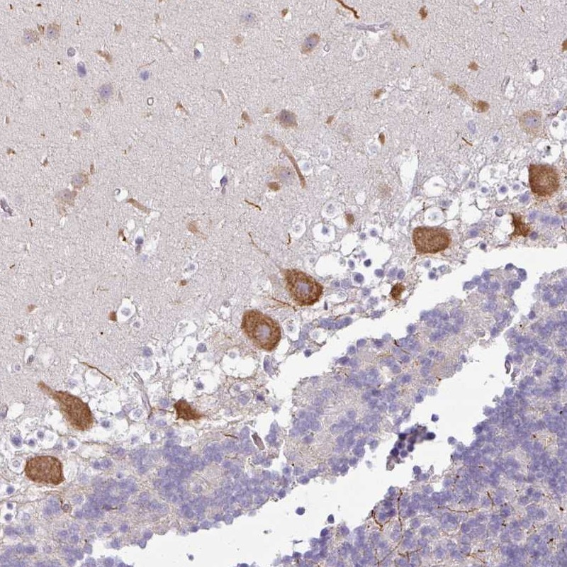 Anti-OR52D1 Antibody