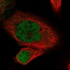 Immunofluorescent staining of human cell line A-431 shows localization to nucleoplasm.