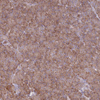 Anti-OR10Q1 Antibody