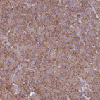 Anti-OR10Q1 Antibody