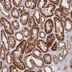 Immunohistochemical staining of human kidney shows strong granular cytoplasmic positivity in cells in tubules.