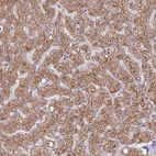 Immunohistochemical staining of human liver shows moderate granular cytoplasmic positivity in hepatocytes.