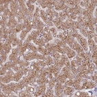 Immunohistochemical staining of human liver shows moderate granular cytoplasmic positivity in hepatocytes.