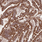 Immunohistochemical staining of human duodenum shows strong granular cytoplasmic positivity in glandular cells.