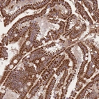 Immunohistochemical staining of human duodenum shows strong granular cytoplasmic positivity in glandular cells.