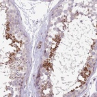 Anti-NBPF3 Antibody