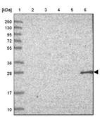 Lane 1: Marker [kDa] 250, 130, 95, 72, 55, 36, 28, 17, 10_br/_Lane 2: Human cell line RT-4_br/_Lane 3: Human cell line U-251 MG_br/_Lane 4: Human plasma_br/_Lane 5: Human Liver tissue_br/_Lane 6: Human Tonsil tissue