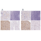 Immunohistochemical staining of human kidney, lymphoid tissues, placenta and skeletal muscle using Anti-IGFBP1 antibody HPA046972 (A) shows similar protein distribution across tissues to independent antibody HPA050640 (B).