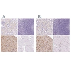 Immunohistochemical staining of human kidney, lymphoid tissues, placenta and skeletal muscle using Anti-IGFBP1 antibody HPA046972 (A) shows similar protein distribution across tissues to independent antibody HPA050640 (B).