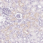 Immunohistochemical staining of human kidney shows moderate granular cytoplasmic positivity in cells in tubules.