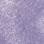 Immunohistochemical staining of human tonsil shows no positivity in non-germinal center cells as expected.