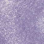 Immunohistochemical staining of human tonsil shows no positivity in non-germinal center cells as expected.
