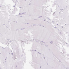 Immunohistochemical staining of human skeletal muscle shows no positivity in myocytes as expected.