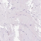 Immunohistochemical staining of human skeletal muscle shows no positivity in myocytes as expected.
