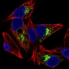 Immunofluorescent staining of human cell line Hep G2 shows localization to the Golgi apparatus.