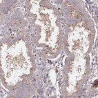 Anti-IDUA Antibody