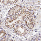 Immunohistochemical staining of human Duodenum shows moderate cytoplasmic positivity in glandular cells.