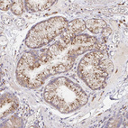 Anti-IDUA Antibody