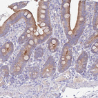 Anti-SLC44A4 Antibody