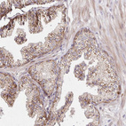 Immunohistochemical staining of human Prostate shows moderate cytoplasmic positivity in glandular cells.
