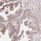 Anti-IDUA Antibody