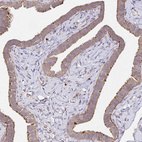 Immunohistochemical staining of human Fallopian tube shows moderate cytoplasmic positivity in glandular cells.