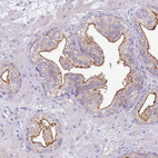 Anti-SLC44A4 Antibody