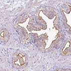 Immunohistochemical staining of human prostate shows strong positivity in apical membrane in glandular cells.