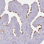 Immunohistochemical staining of human Fallopian tube shows strong positivity in apical membrane in ciliated glandular cells.