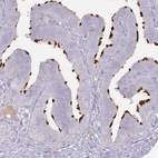 Immunohistochemical staining of human Fallopian tube shows strong positivity in apical membrane in ciliated glandular cells.