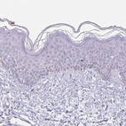 Immunohistochemical staining of human skin shows no positivity in squamous epithelial cells as expected.