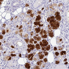 Immunohistochemical staining of human salivary gland shows strong cytoplasmic positivity in glandular cells.