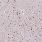 Anti-CELF6 Antibody