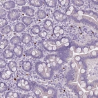 Immunohistochemical staining of human duodenum shows strong nuclear positivity in leukocytes.