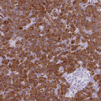 Immunohistochemical staining of human pancreas shows strong cytoplasmic positivity in exocrine glandular cells.