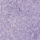Immunohistochemical staining of human tonsil shows strong nuclear positivity in leukocytes.