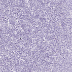 Immunohistochemical staining of human tonsil shows no positivity in non-germinal center cells as expected.