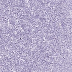 Immunohistochemical staining of human tonsil shows no positivity in non-germinal center cells as expected.